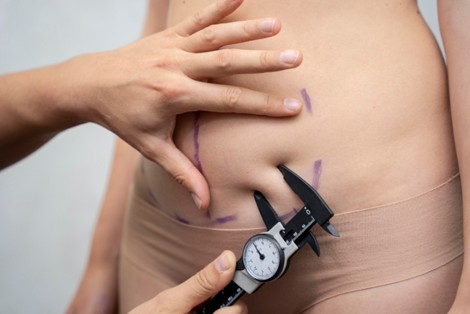 lipotransferencia en medellin