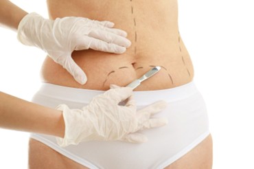 Mujer realizándose cirugía plástica en Medellín