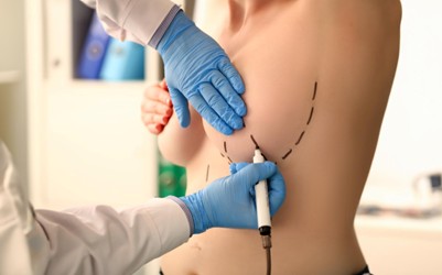 Diferencia entre mamoplastia, mastopexia y reducción mamaria
